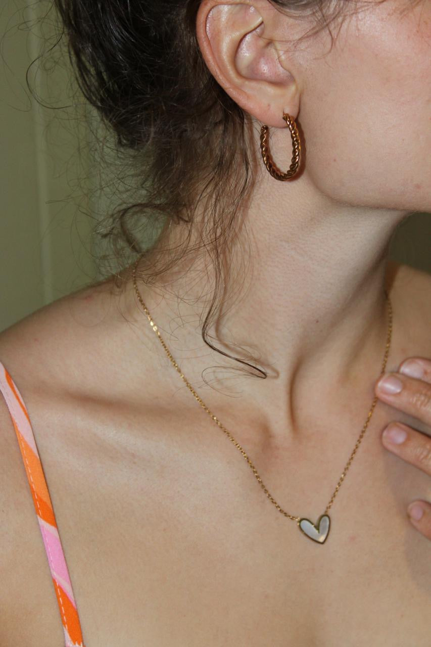 Stonekiss